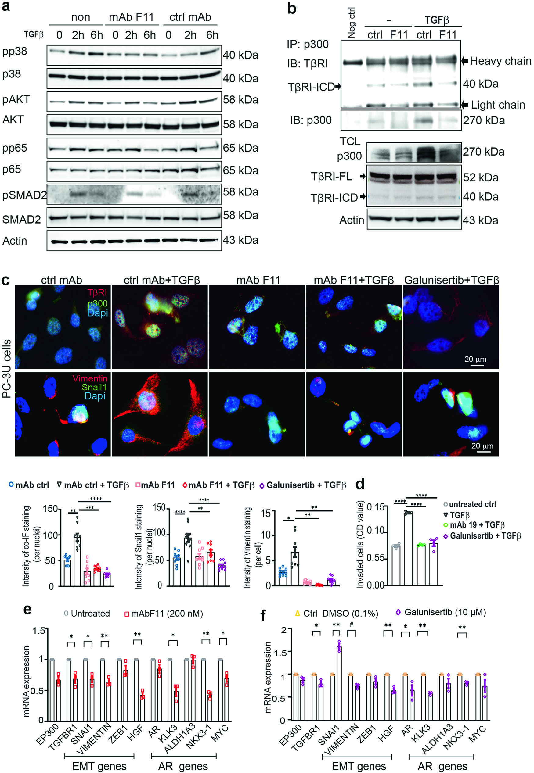Figure 4 - mAbF11 effects on EMT markers and TGFβ signaling in mCRPC cells